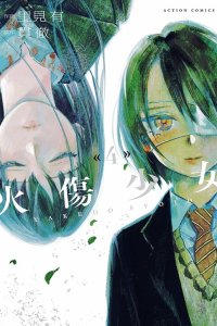 Baca Burned Girl Bahasa Indonesia