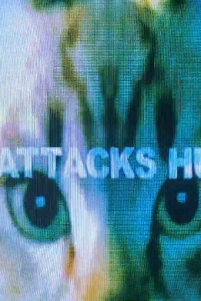 Dog Attacks Human