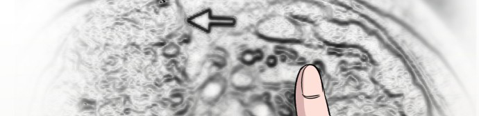 A.I. Doctor Chapter 8 - halaman 19