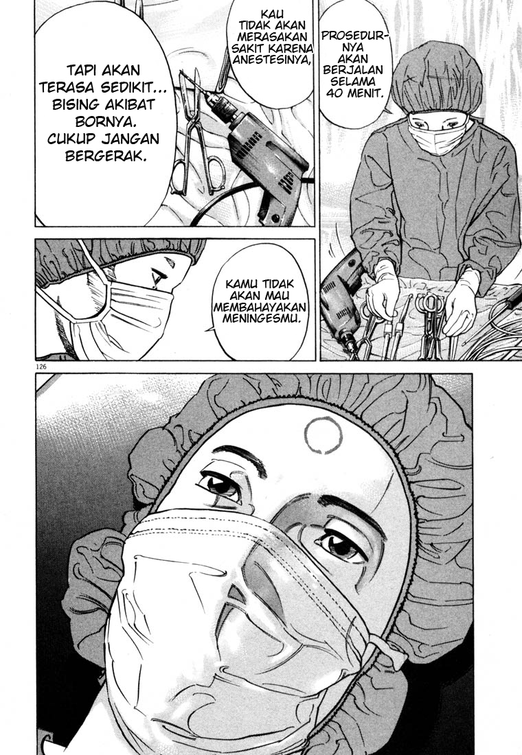 Homunculus Chapter 0 - halaman 126