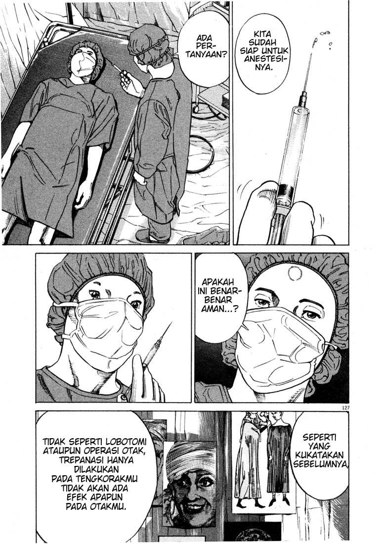 Homunculus Chapter 0 - halaman 127