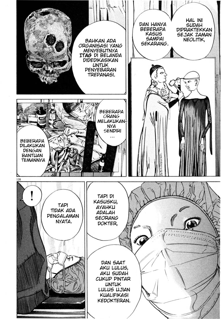 Homunculus Chapter 0 - halaman 128