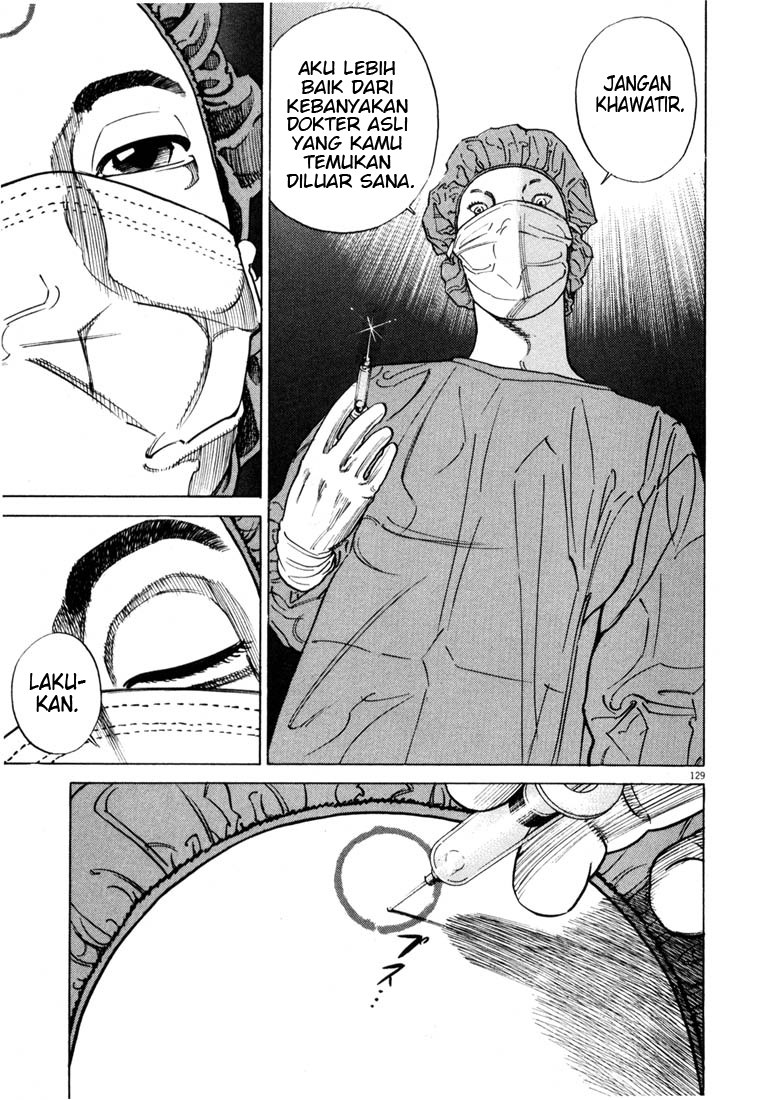 Homunculus Chapter 0 - halaman 129