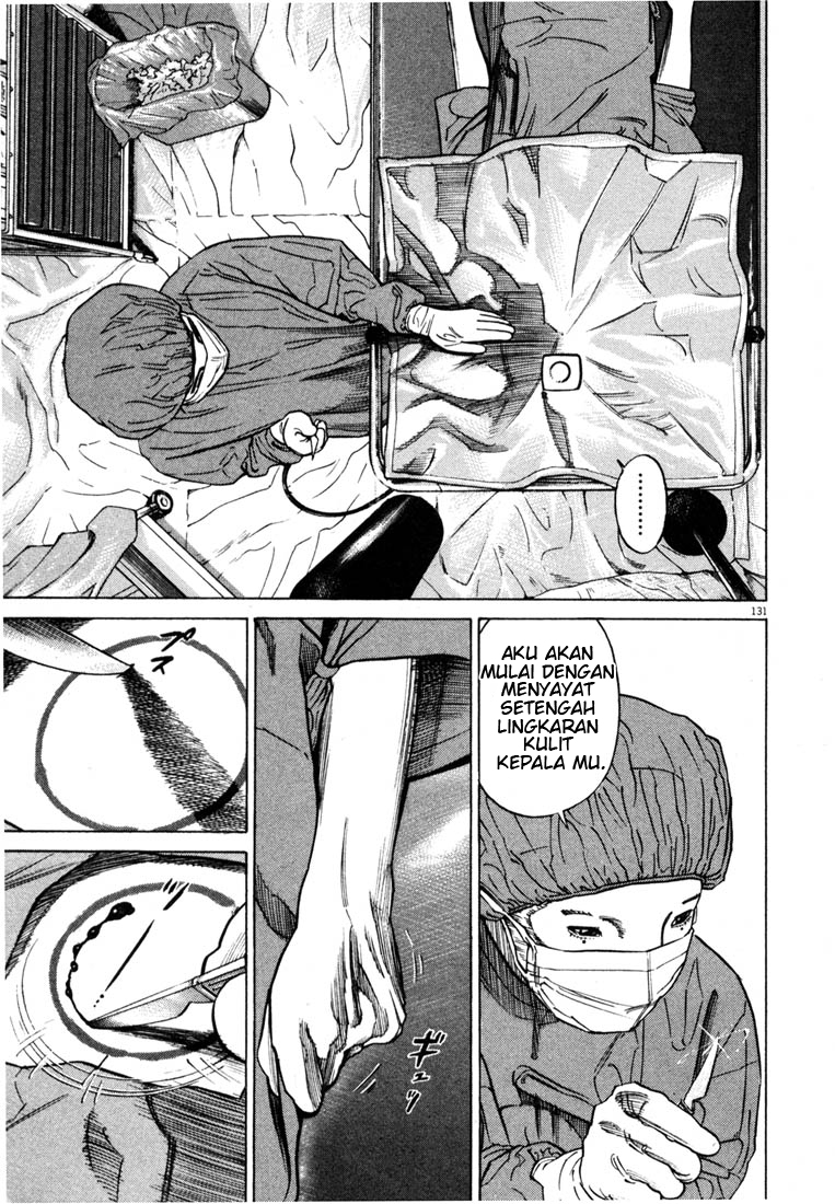 Homunculus Chapter 0 - halaman 131