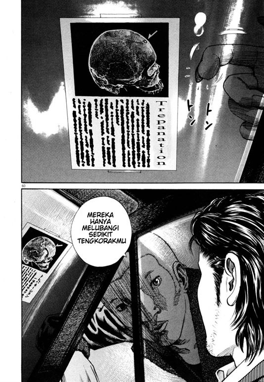 Homunculus Chapter 0 - halaman 62