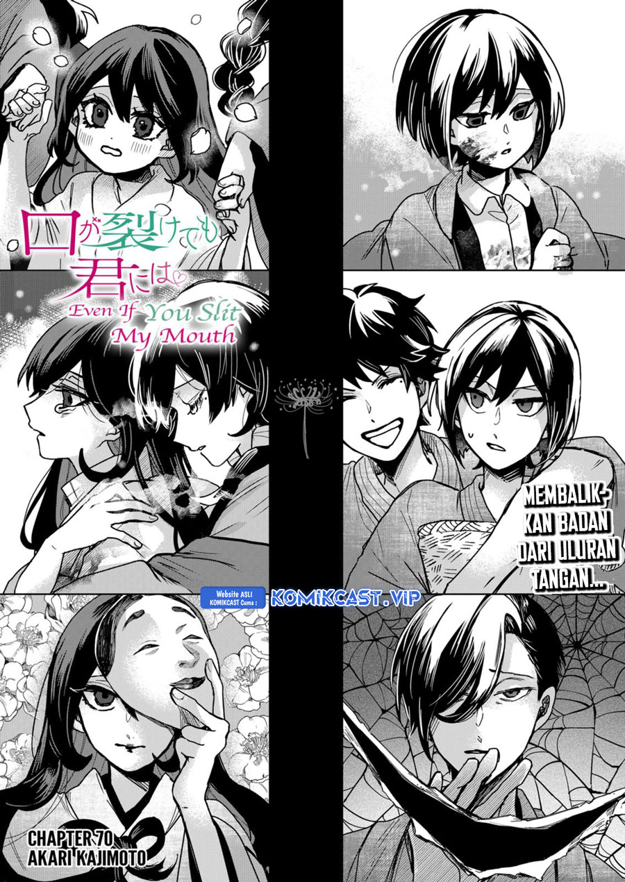 Kuchi ga Saketemo Kimi ni wa Chapter 70 - halaman 9