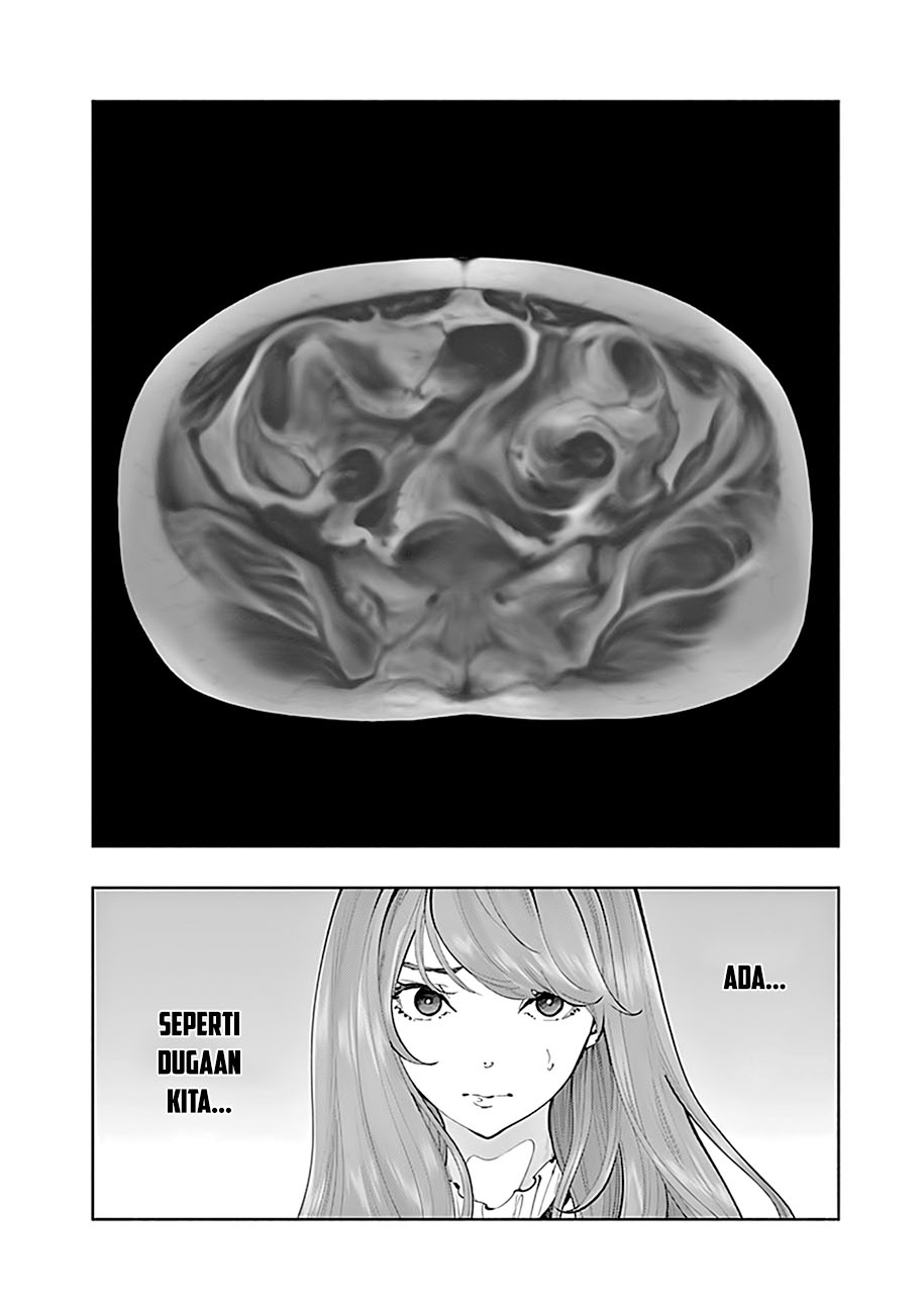 Radiation House Chapter 67 - halaman 16